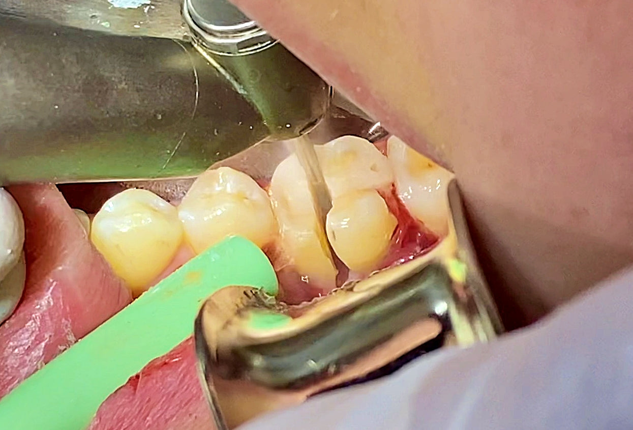 THE Extraction Course – The Extraction Course